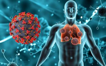 Respiratory Syncytial Virus (RSV) Therapeutics Market