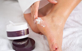 Foot Creams and Lotions Market