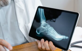 Digital Radiography Market