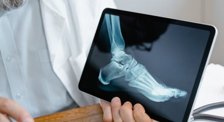 Digital Radiography Market