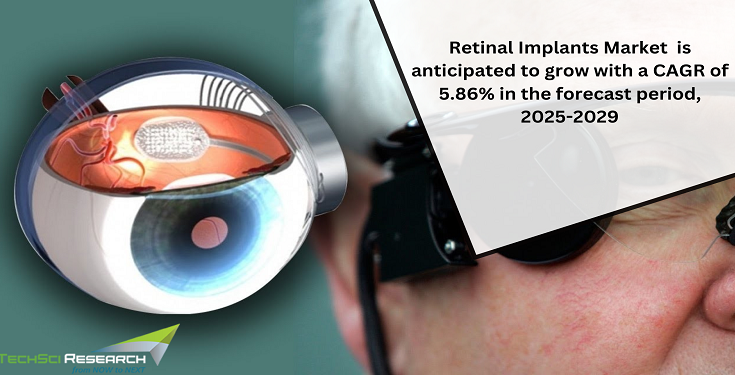 Retinal Implants Market