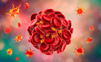 Thrombophilia Market