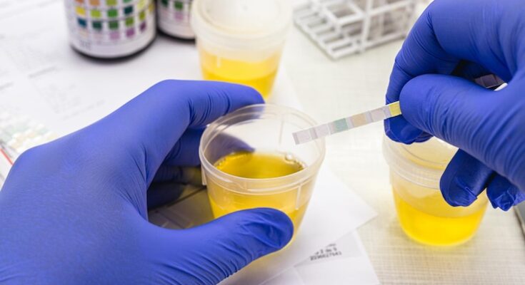 Urine Sediment Testing Market