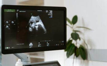 Doppler Ultrasound Market