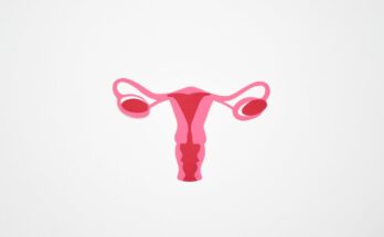 Uterine Fibroids Treatment Market