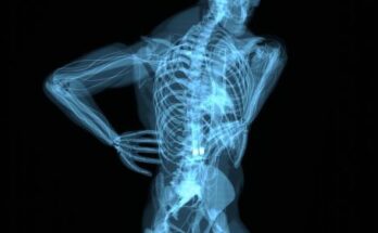 Spinal Imaging Market