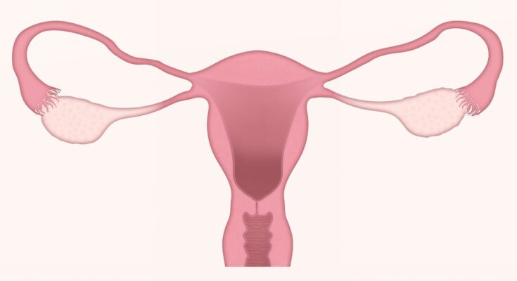 Vaginal Sling Global Market