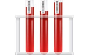 Global Blood Collection Tubes Market