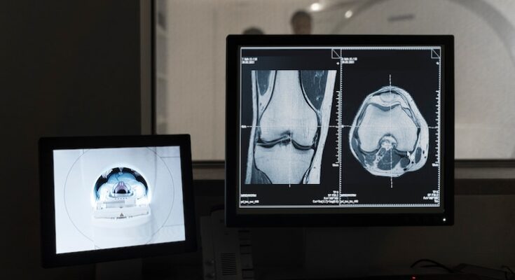 Digital X-Ray Devices Market Overview