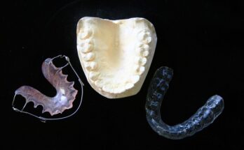 Invisible Orthodontics Market