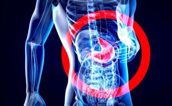 Viral Gastroenteritis Market Size, Share, Analysis And Forecast 2033