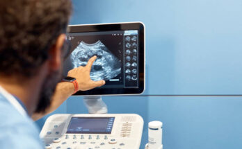 Point Of Care Ultrasound Market