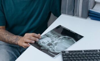 Dental Digital X-Ray