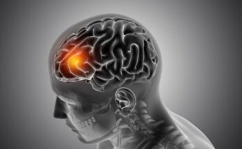 Pituitary Dwarf Treatment Market Report 2024 - Pituitary Dwarf Treatment Market Size and Forecast